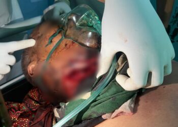 Pria di Bener Meriah Ditemukan Kondisi Leher Tergorok di Kebun Kopi