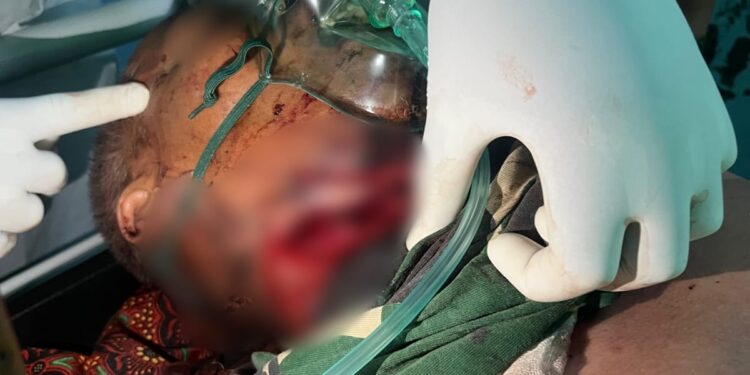 Pria di Bener Meriah Ditemukan Kondisi Leher Tergorok di Kebun Kopi